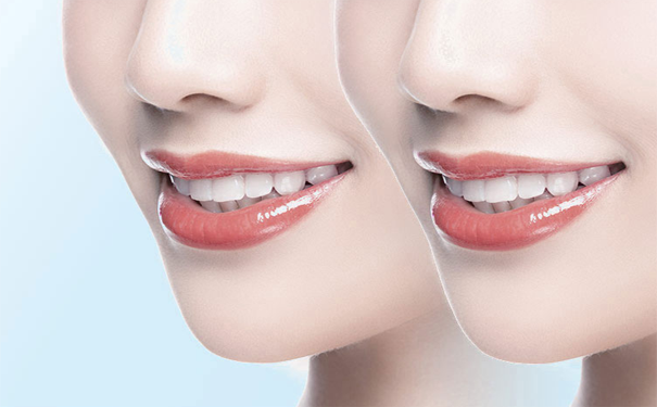 泰安种牙：女性做种植牙的注意事项