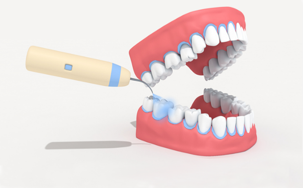 泰安整牙：单侧咀嚼有哪些危害？